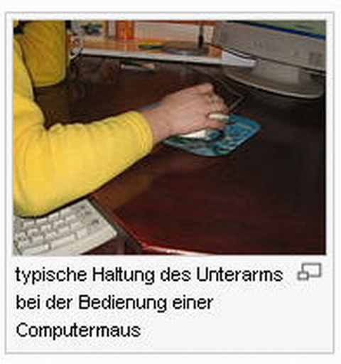 EN:RSI Syndrom typical position forearm during computer mouse position DE: typische haltung des unterarms