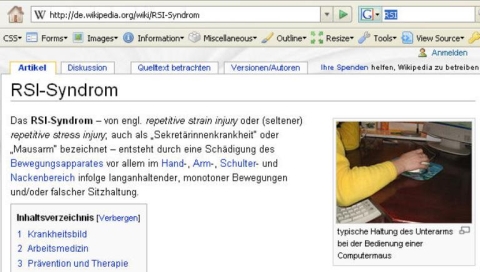RSI Syndrom Wiki